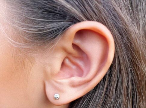 Oroclear