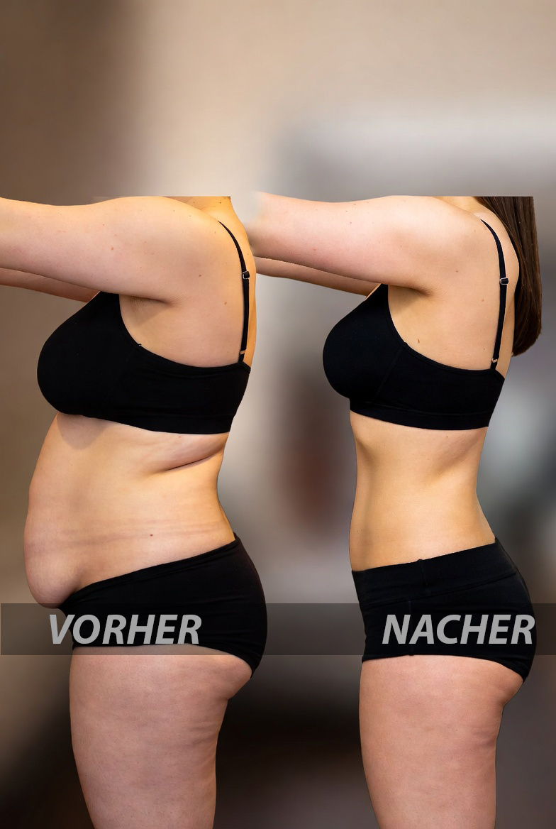 Vorhher