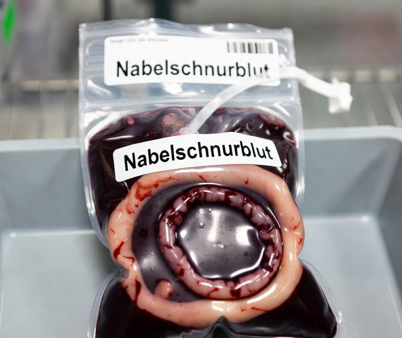 Nabelschnurblut